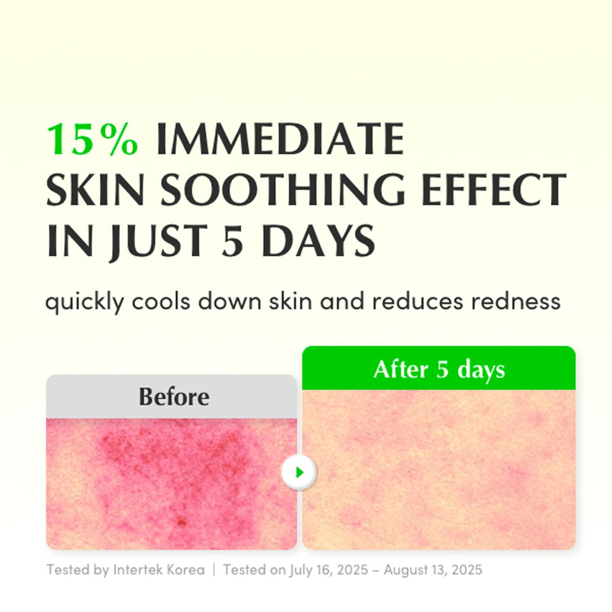 Eqqualberry Aloe PDRN Calming Serum – Cica, Hydrating & Soothing Sensitive Skin