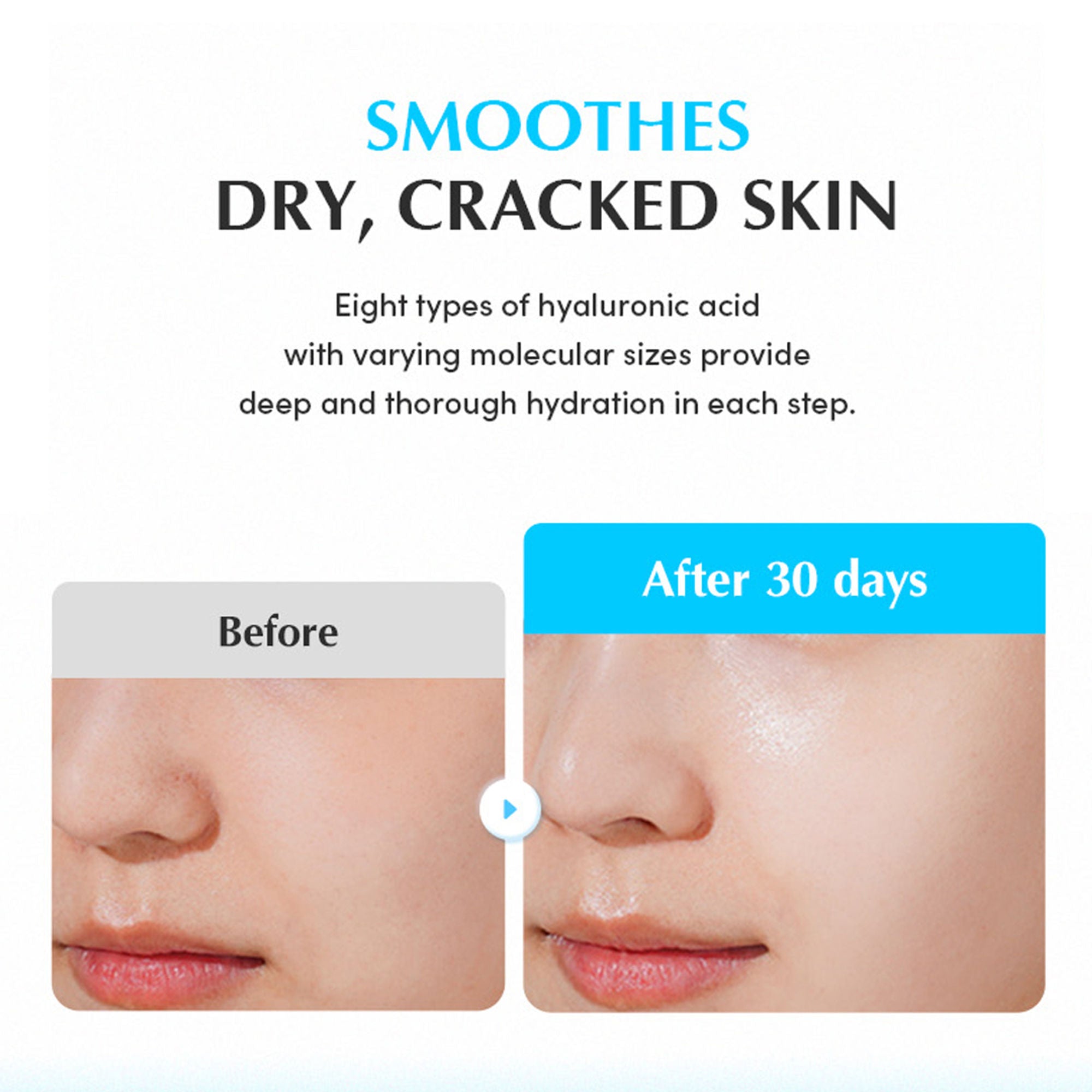 Eqqualberry Swimming Pool Hydrating Ampoule – Glass Skin, 5 Berry Complex & Hyaluronic Acid