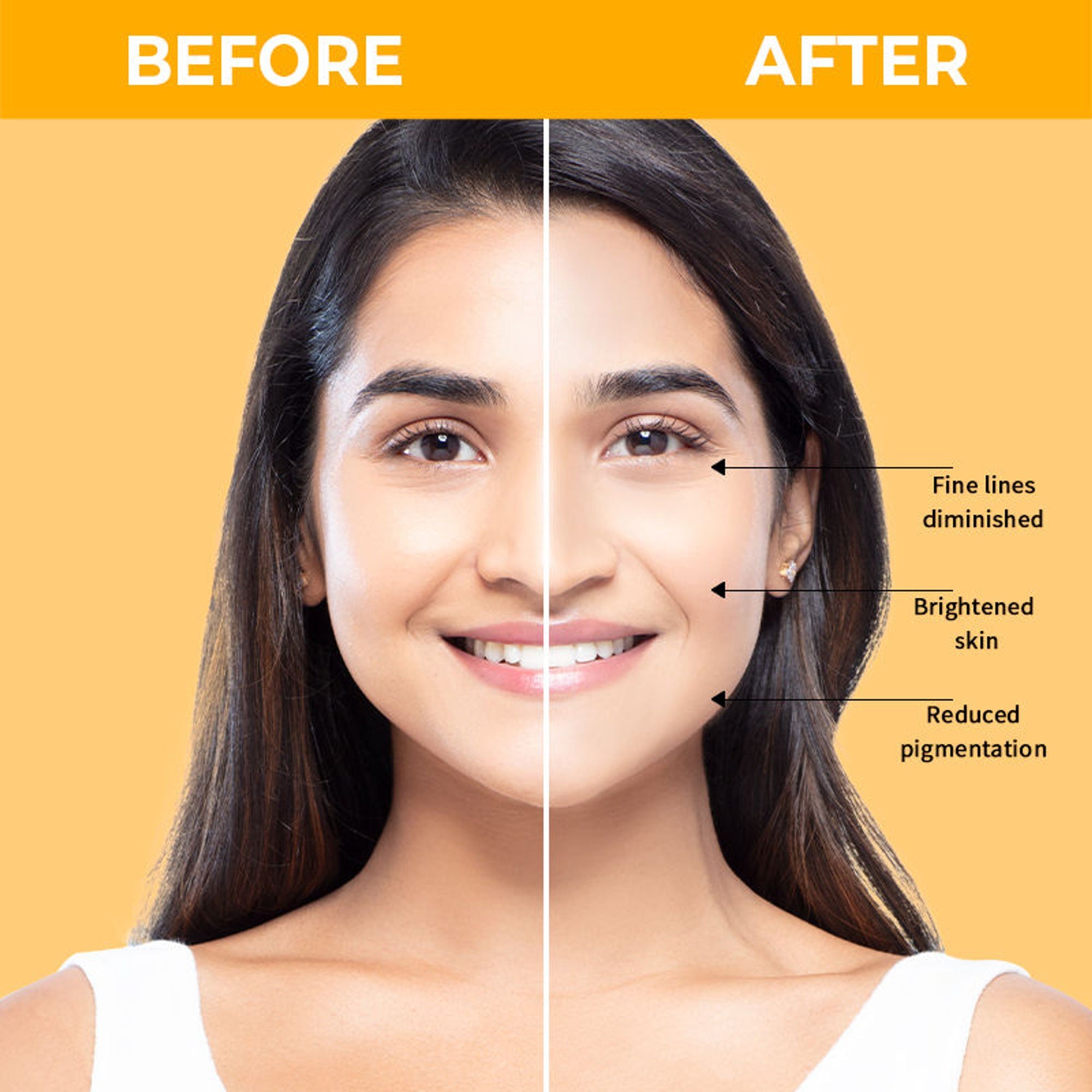 Nykaa SkinRX 20% Vitamin C + 1% Hyaluronic Acid Serum for Bright, Radiant and Hydrated Skin