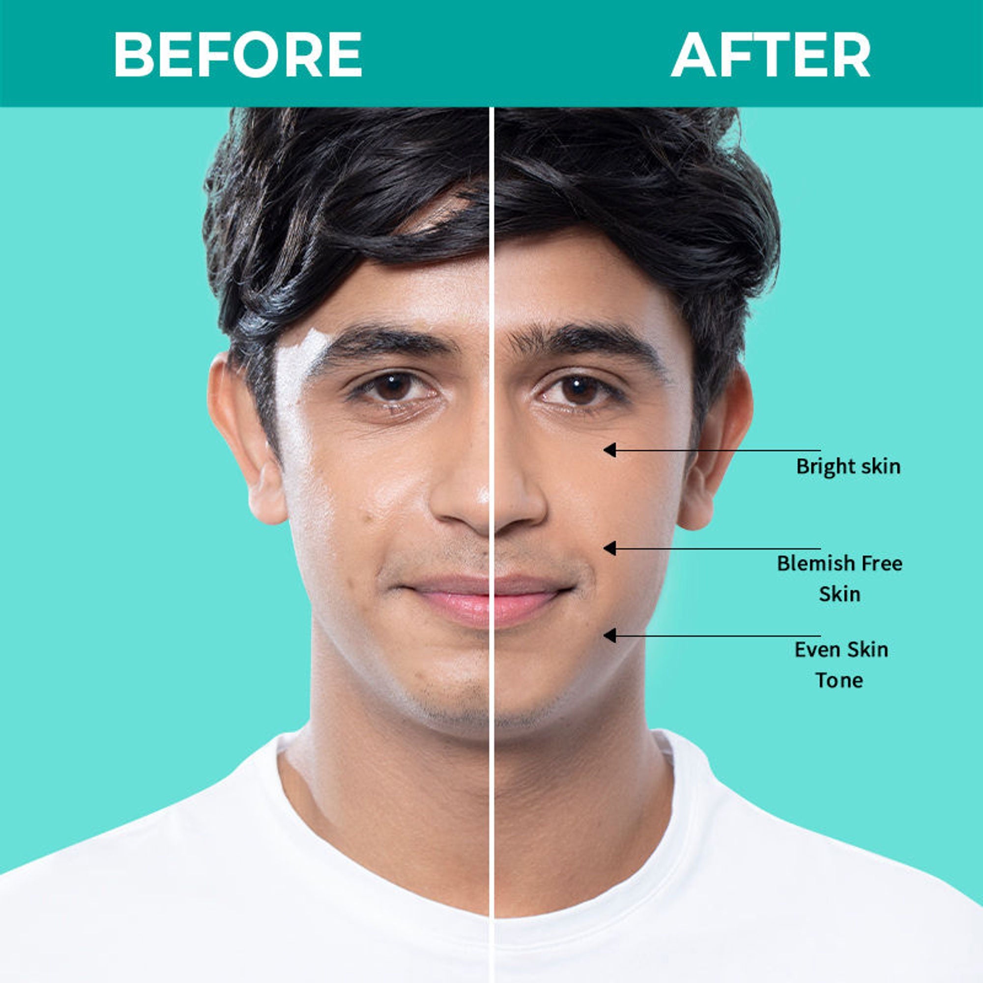 Nykaa SKINRX Spot Corrector with 10% Niacinamide + 1% Zinc Serum to Fade Dark Spots & Pigmentation