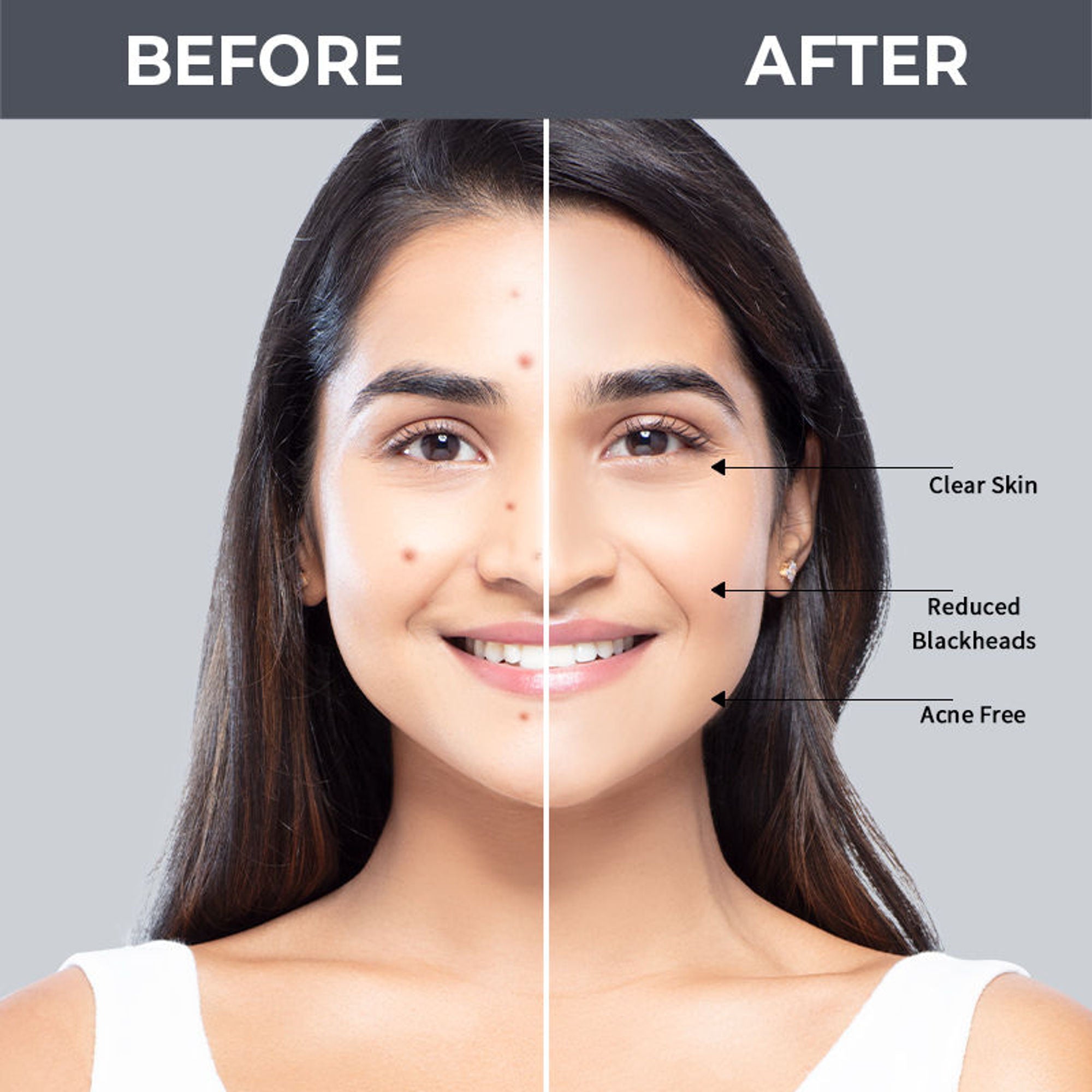 Nykaa SKINRX 2% Salicylic Acid Face Serum