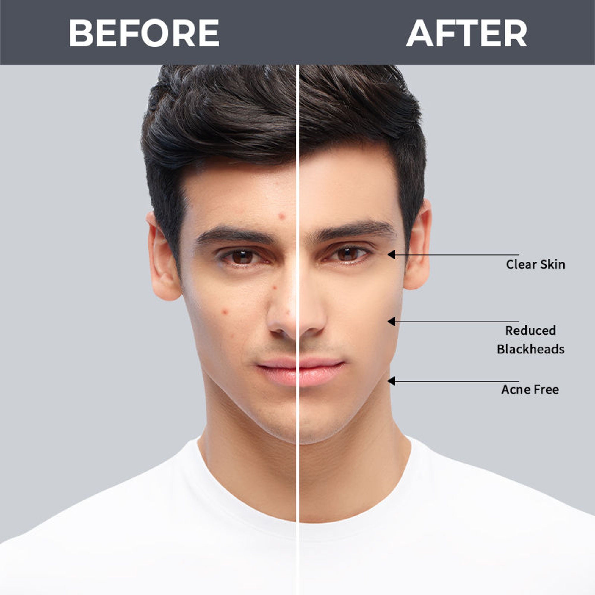 Nykaa SKINRX 2% Salicylic Acid Face Serum