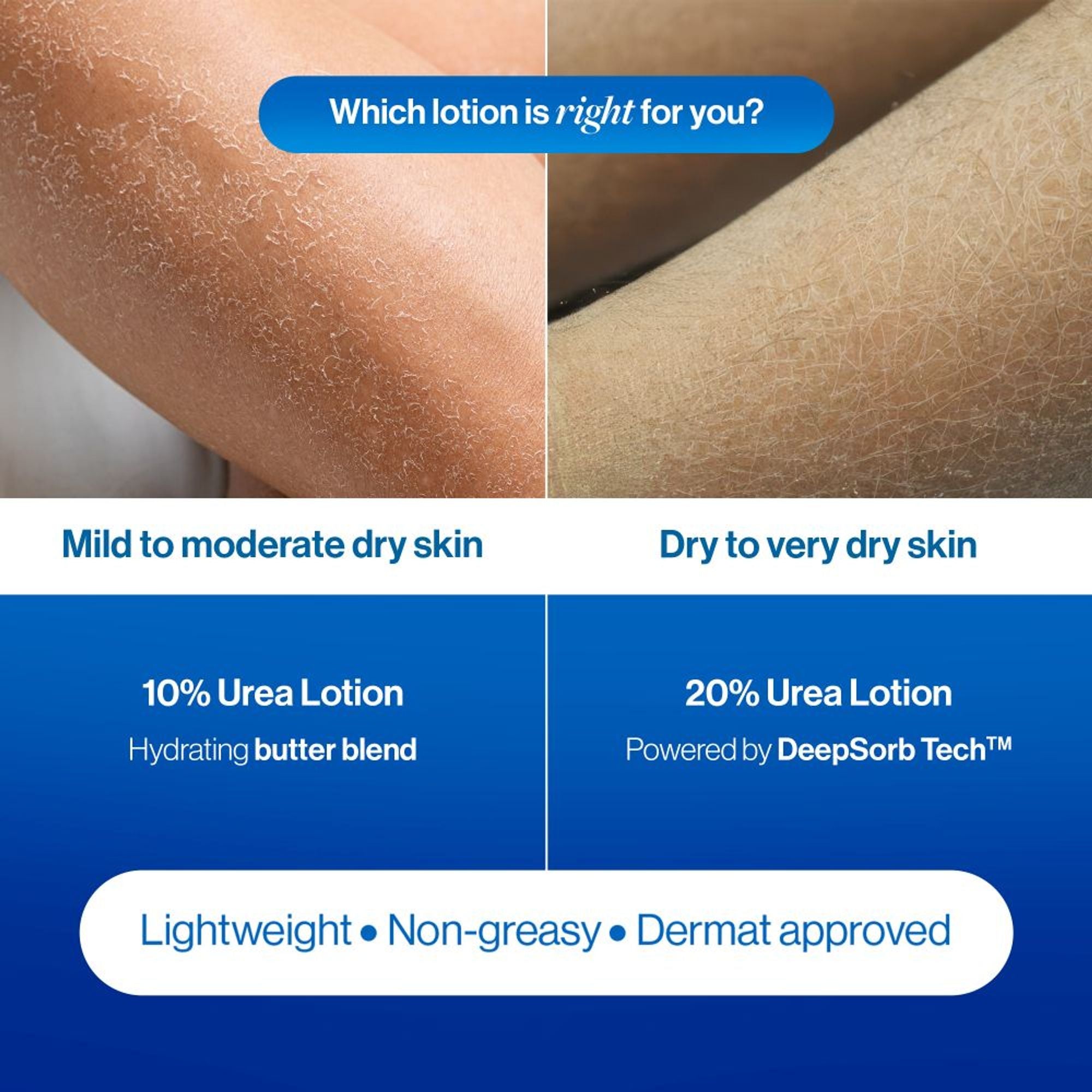 BeBodywise 20% Urea Body Lotion - Advanced Formulation