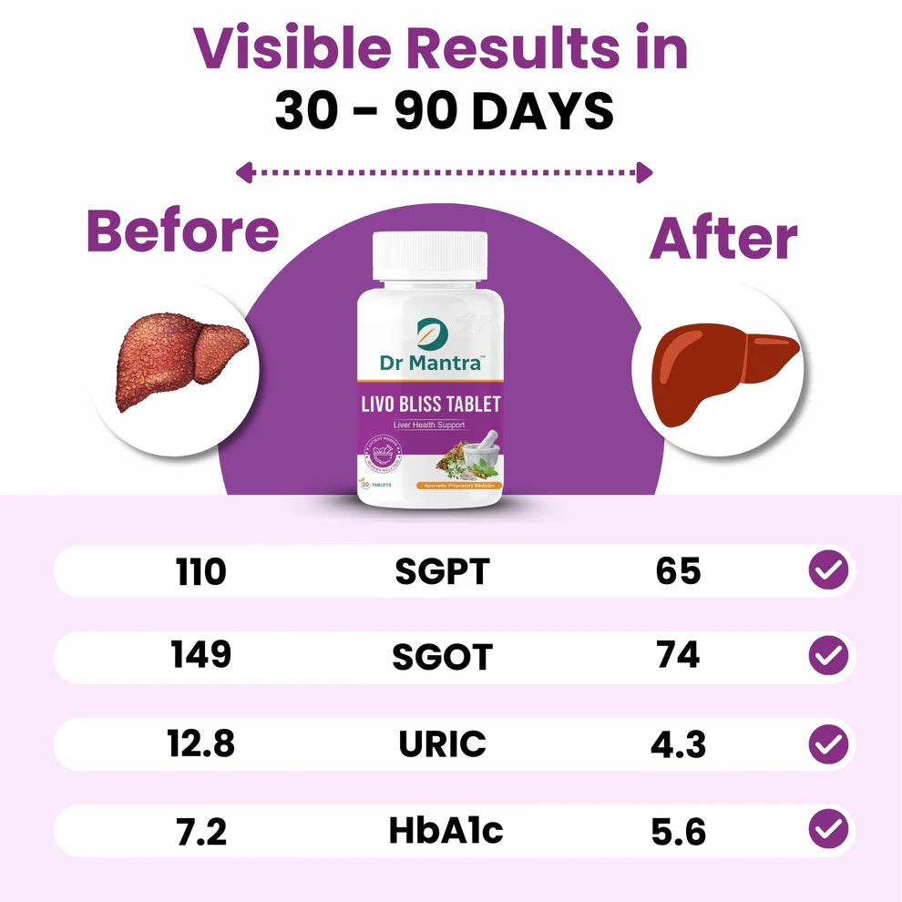 Dr Mantra Ayurvedic Livo Bliss Tablets for Fatty Liver| 30 Tablets