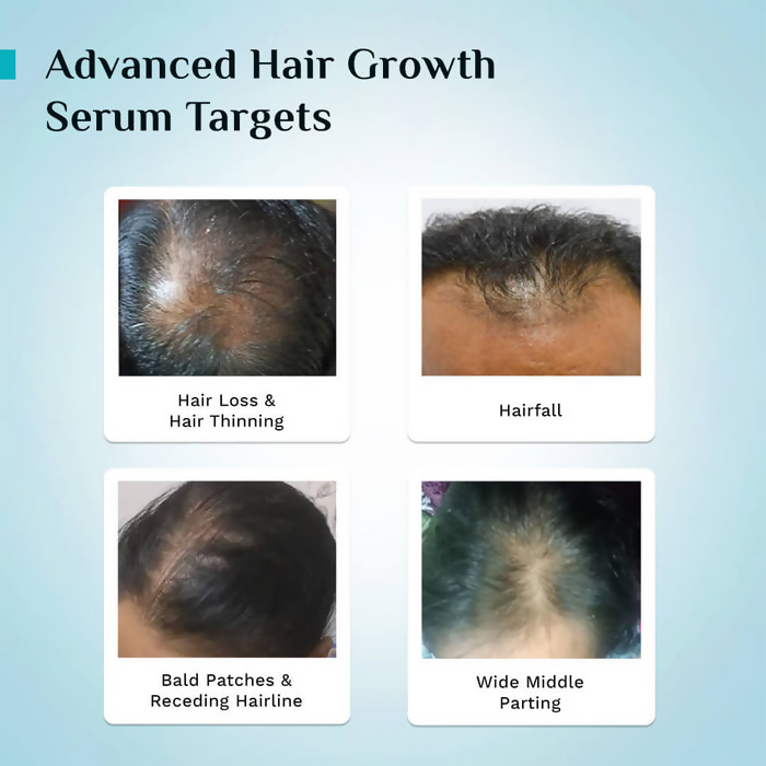 Pilgrim 3% Redensyl, 4% Anagain & 5% Capilia Stem Cell Complex Advanced Hair Growth Serum Roll-On