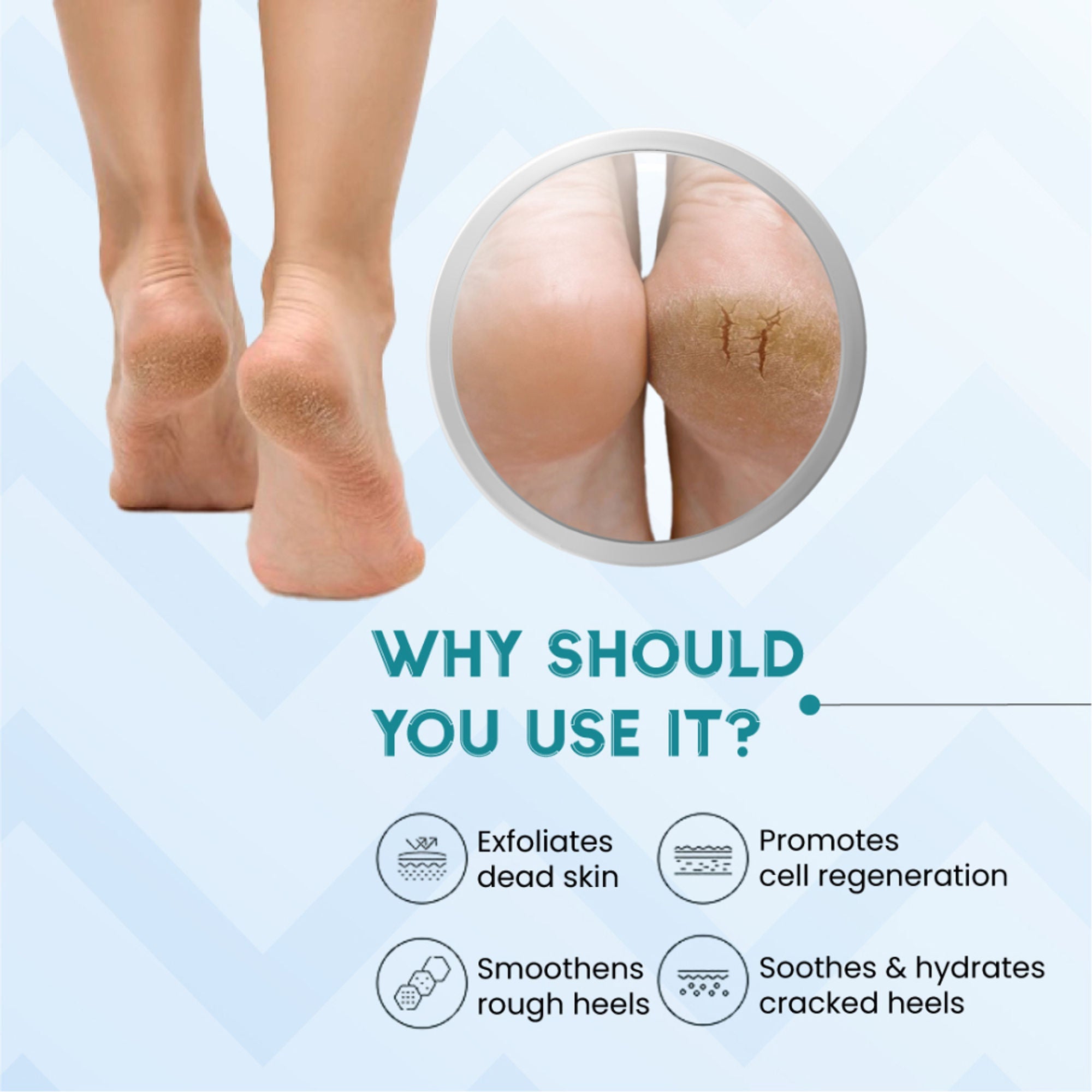 SANCTUS 20% Urea & Hyaluronic Foot Cream Roll On