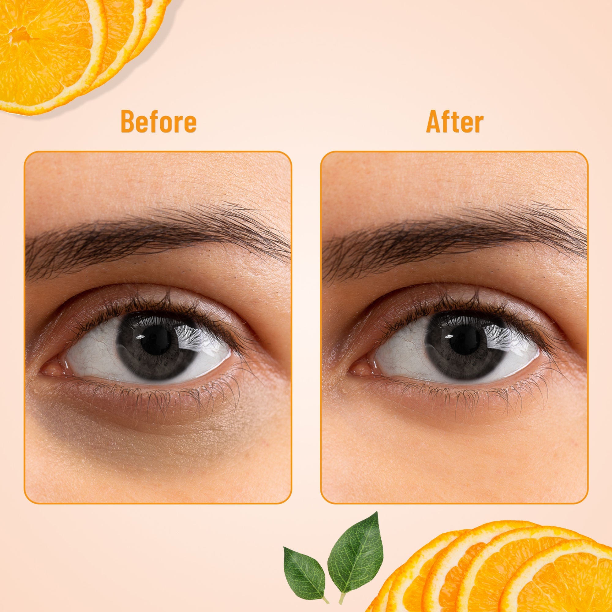 Swiss Beauty Hydra Eye Serum Patches For Dark Circles And Puffiness , Hydrate Skin - Vitamin-C