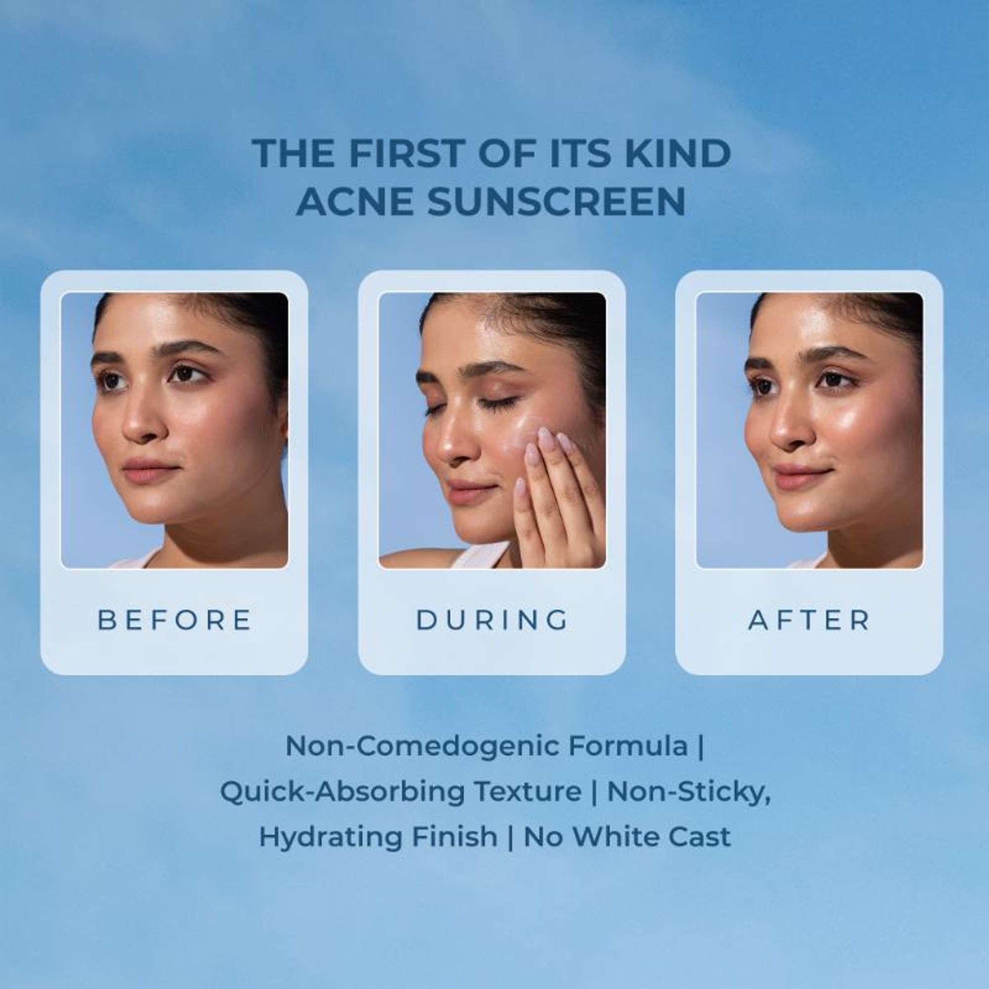 Naturali Acne Control Sunscreen SPF60 With PA+++