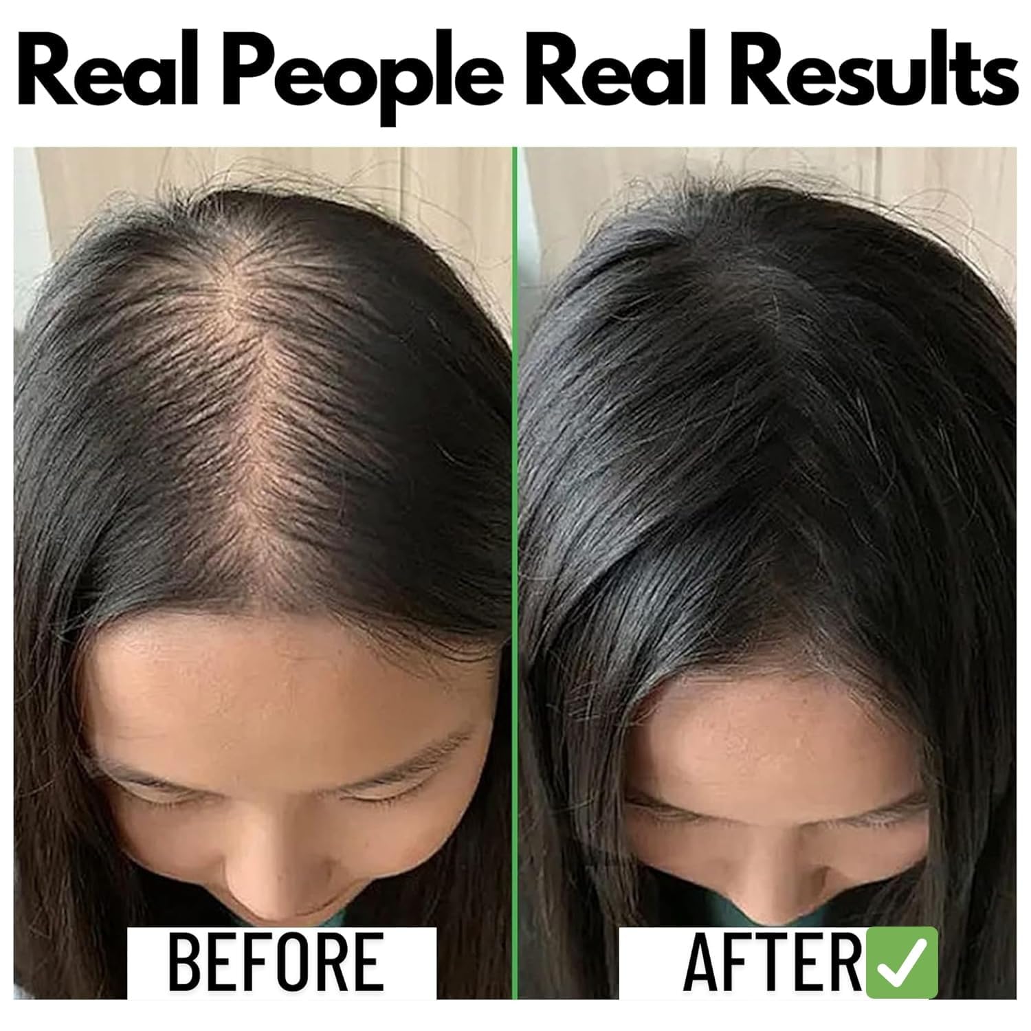 Samisha Rosemary Water Spray For Hair Growth & Thickness