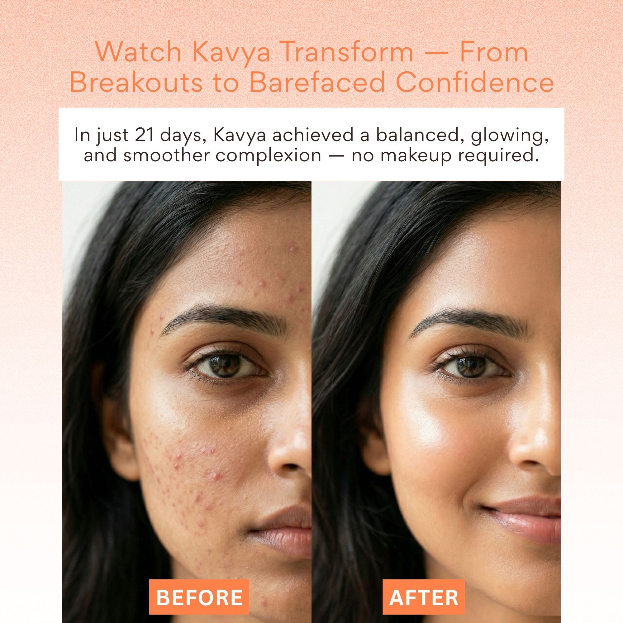 EOB 20% Vitamin C Serum with Hyaluronic Acid Face Serum
