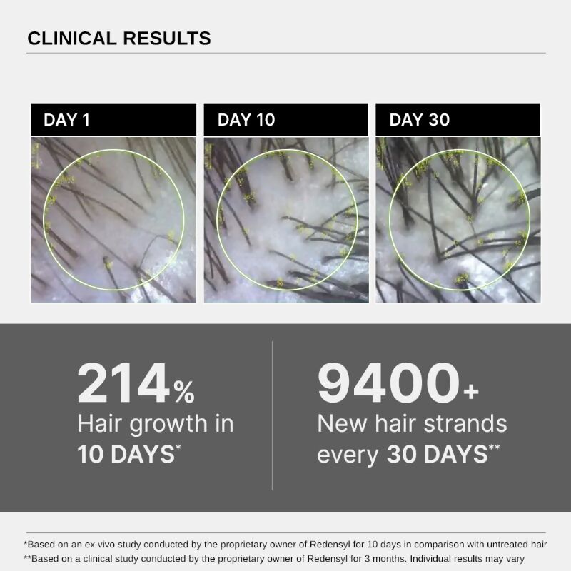 Bare Anatomy Advanced Hair Growth Serum for Scalp 3% Redensyl, 4% Anagain, 3% Baicapil