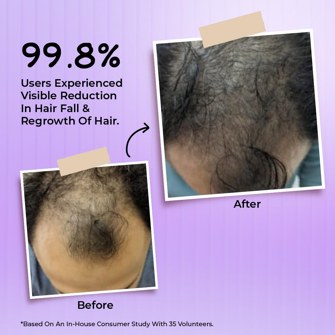 Bakson's Homoeopathy Hair Reviver Mist