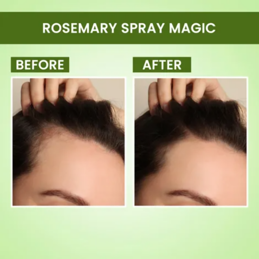 Alps Goodness Hair Growth Essentials Duo Combo