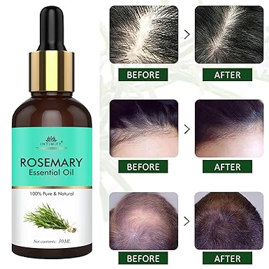 INTIMIFY Rosemary Essential Oil For Hair Growth for Women & Men