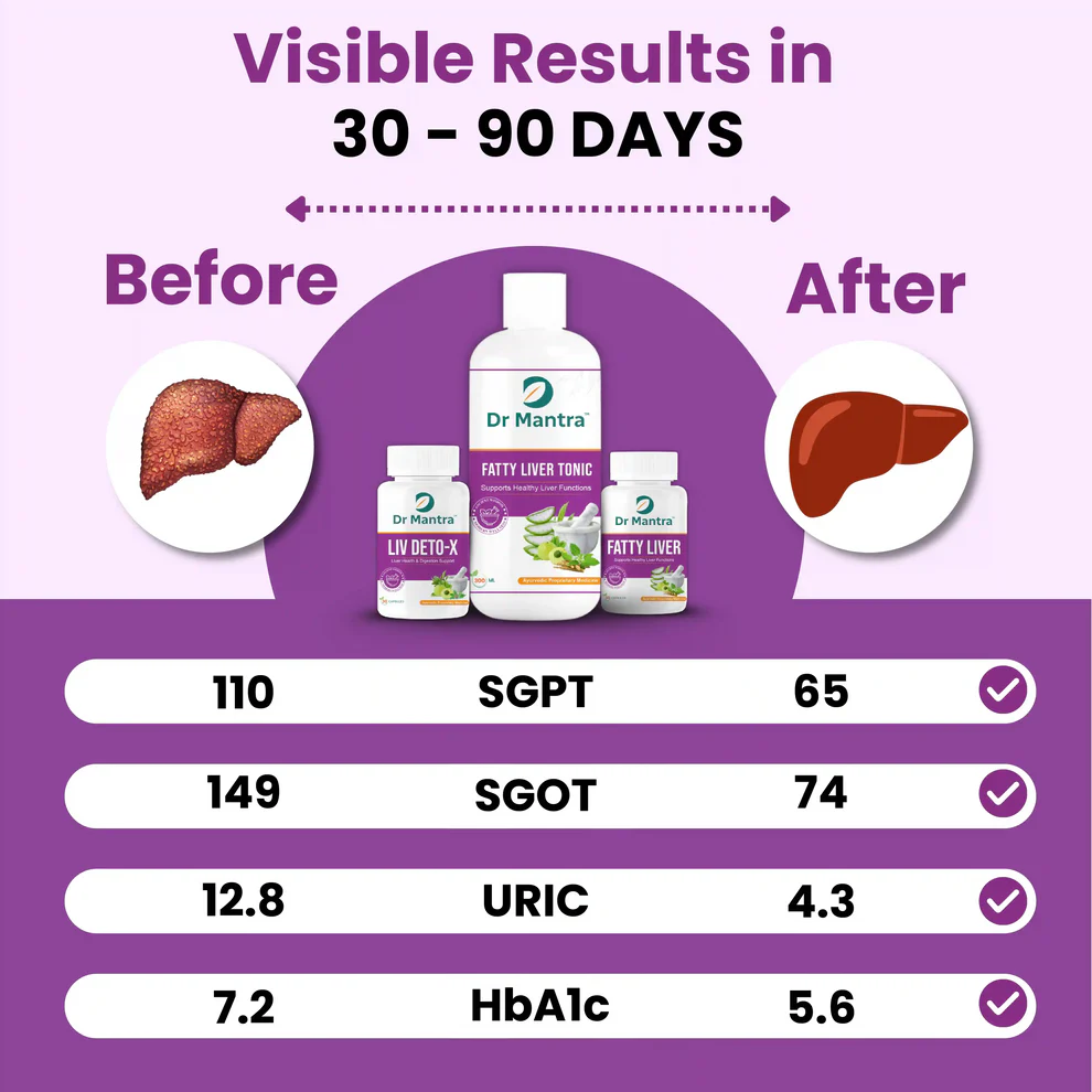 Dr Mantra Fatty Liver Combo - 300ml Fatty LiverTonic + 30 Fatty Liver Capsules + 30 Liver Detox Capsules
