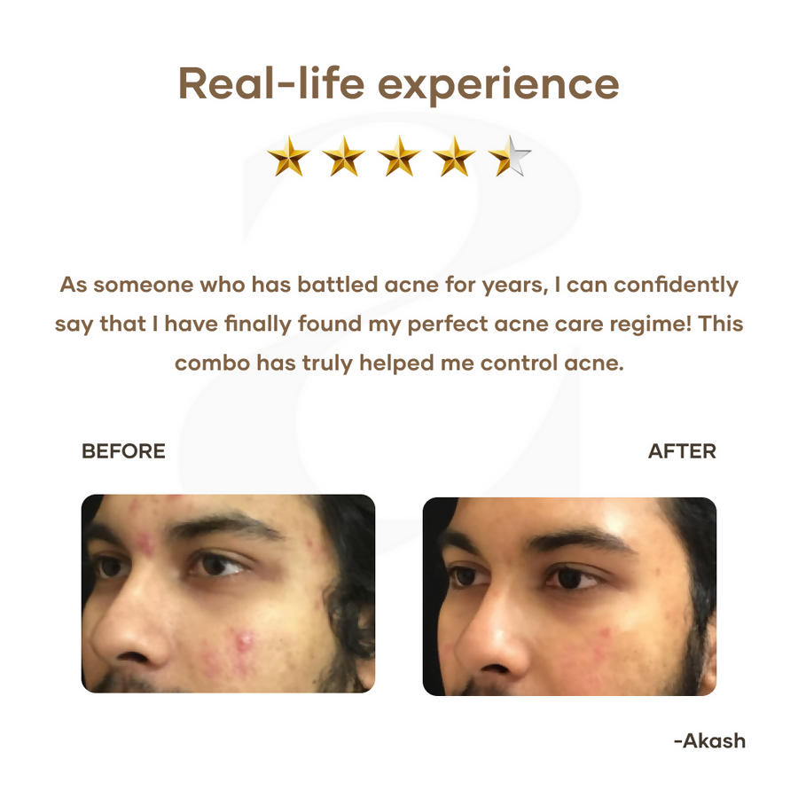 Mars By GHC Mars Ultimate Acne Care Regime Combo