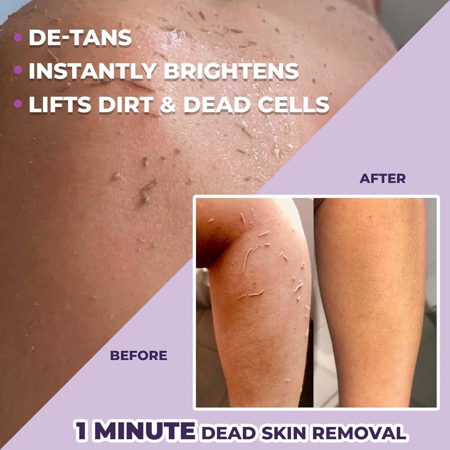Before and after comparison of skin treatment with text highlighting benefits.
