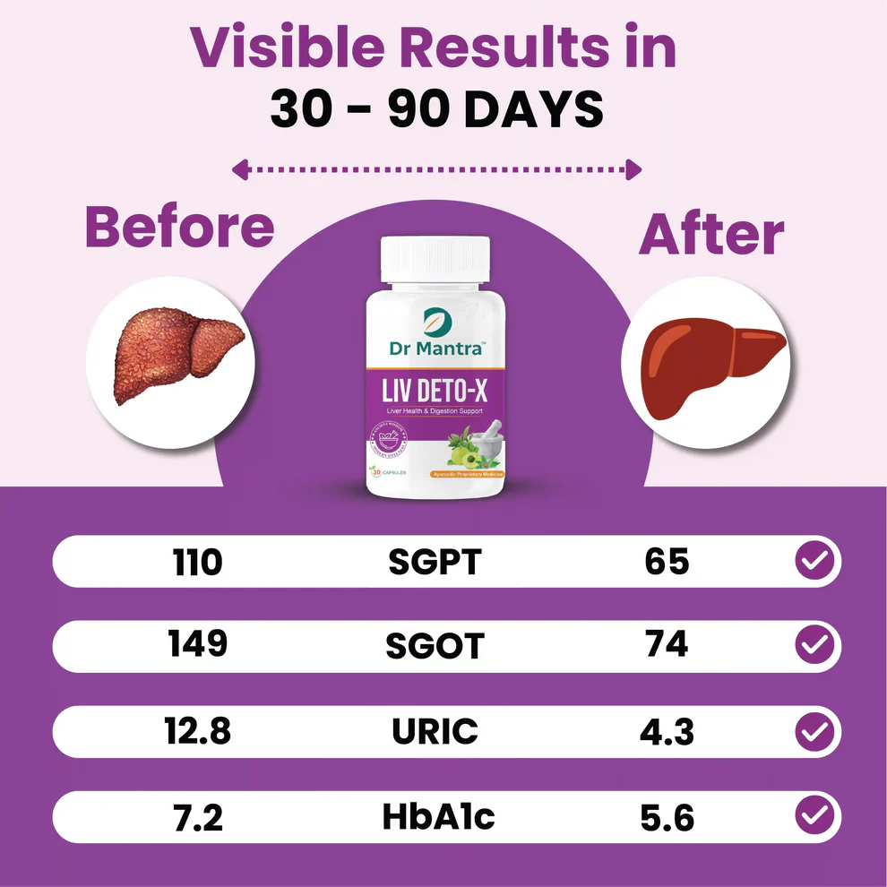 Dr Mantra Liver Detox Capsules for Liver Detox & Overall Liver Health| 30 Capsules