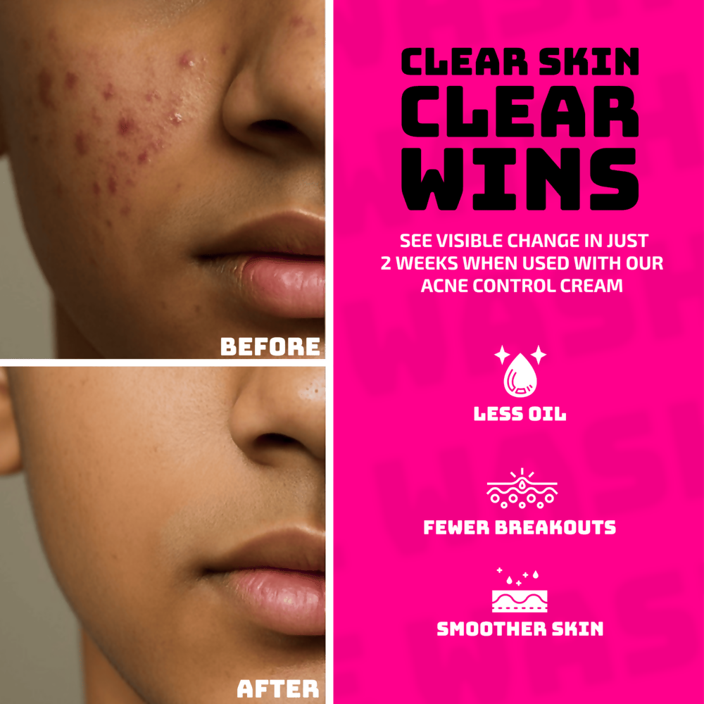 Elemen Anti-Acne Face Wash