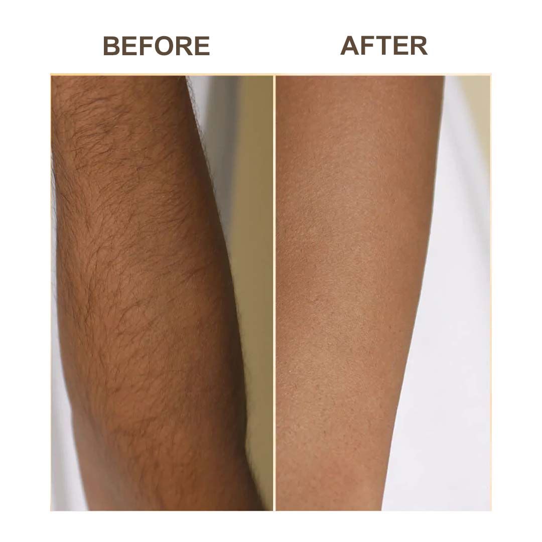 Samisha Haldi Hair Removal Powder