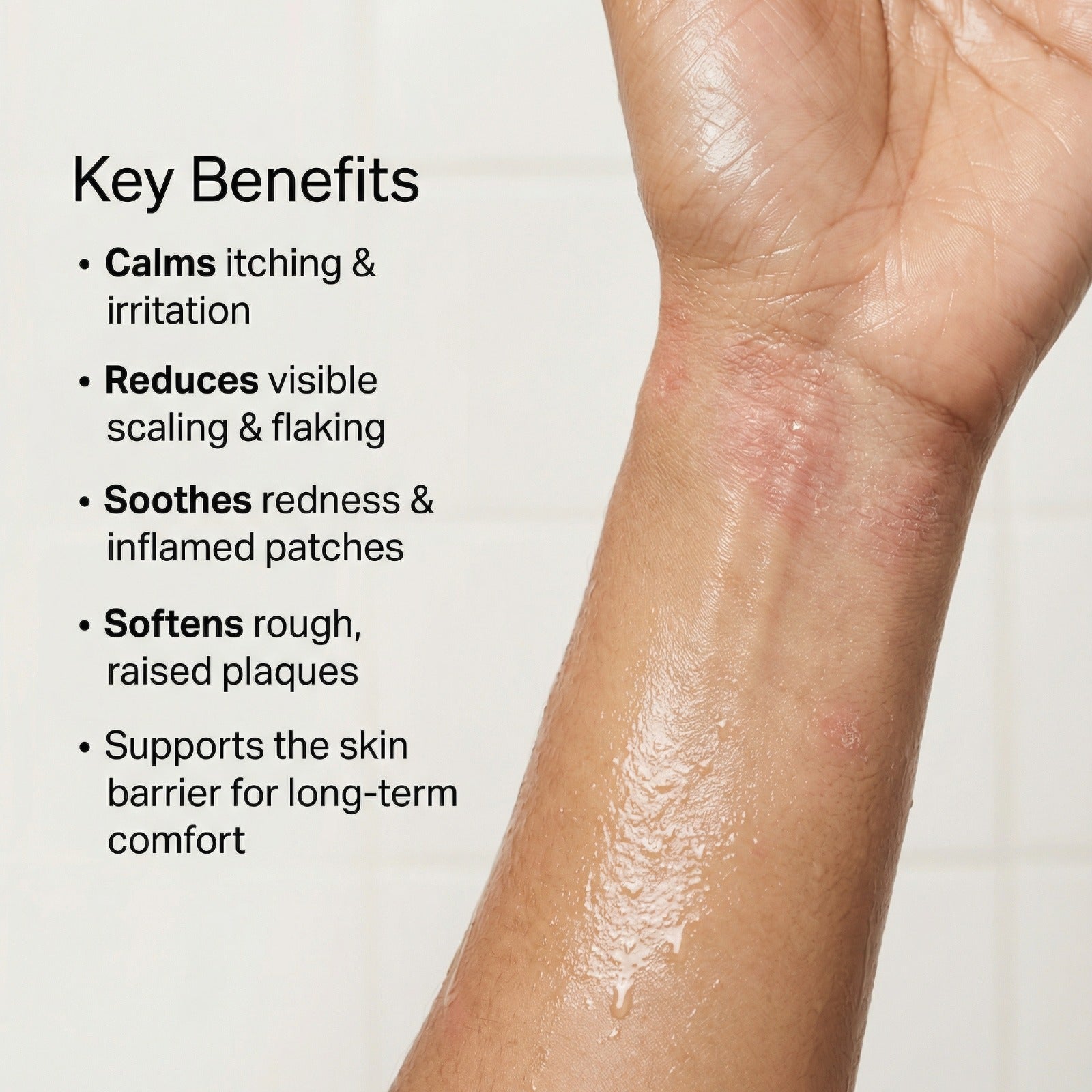 VedicDerm Sensitive Skin Bundle for Psoriasis, Eczema, Atopic Dermatitis
