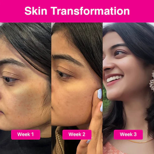 COSIQ ABP-33% Strong Exfoliating Peeling Solution