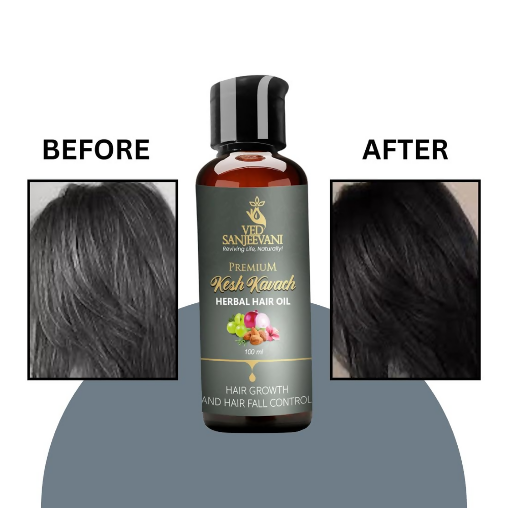 Ved Sanjeevani Kesh Kavach Herbal Hair Oil