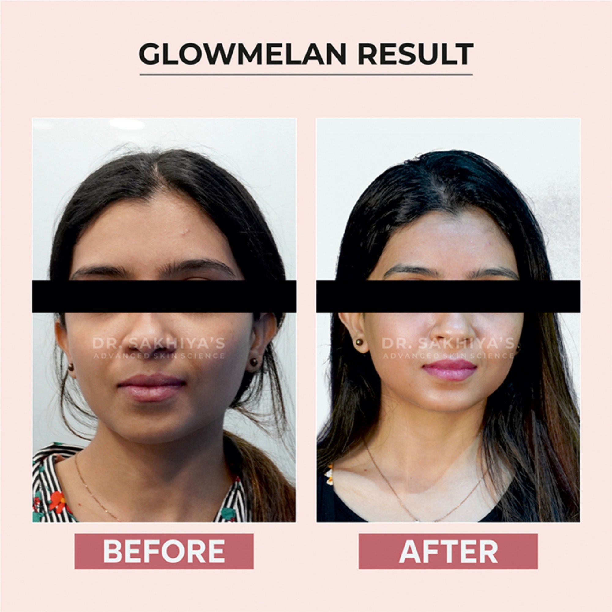 Dr.Sakhiya Glowmelan Brightening & Depigmentation Gel Cream
