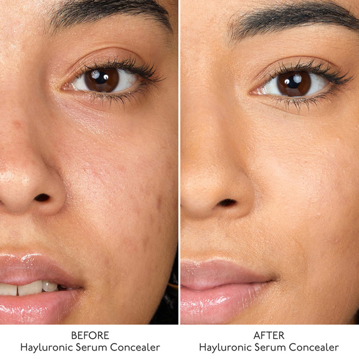 By Terry Hyaluronic Serum Concealer - 5. Cream Beige