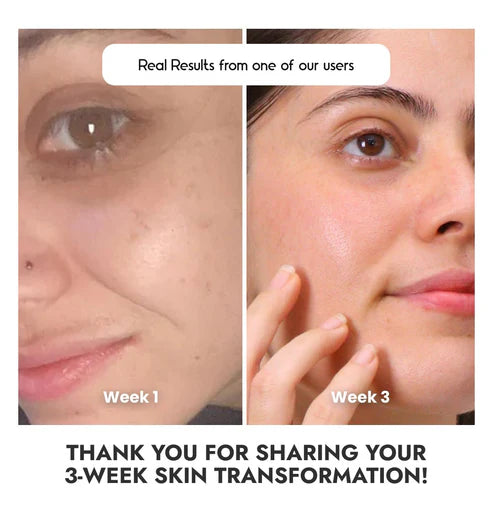 COSIQ Glowing Skin with Vitamin C-23% Serum : Advanced Molecular Skincare Technology 60ml