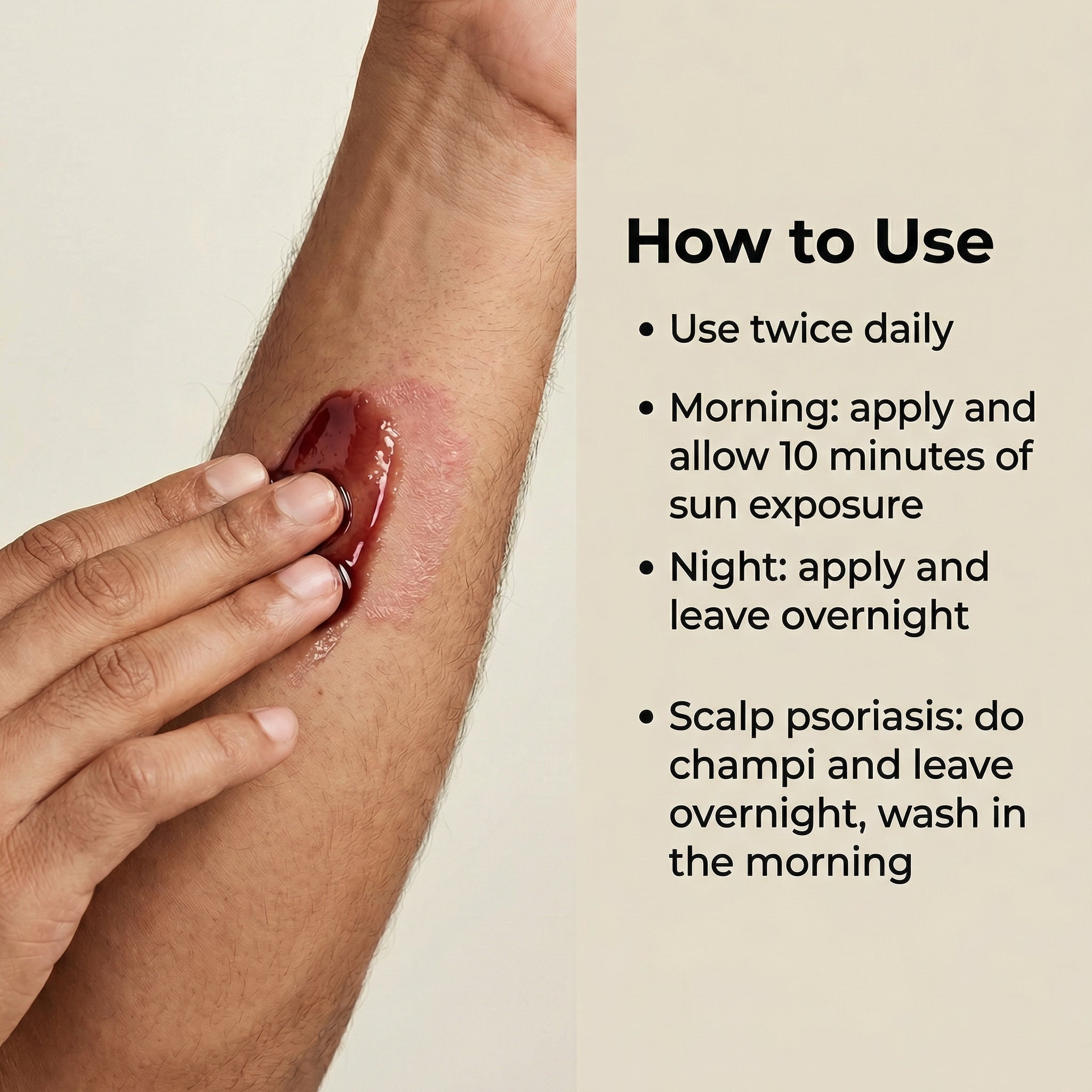 Vedicderm Psoriasis Oil 2-in-1 Skin + Scalp Relief Oil