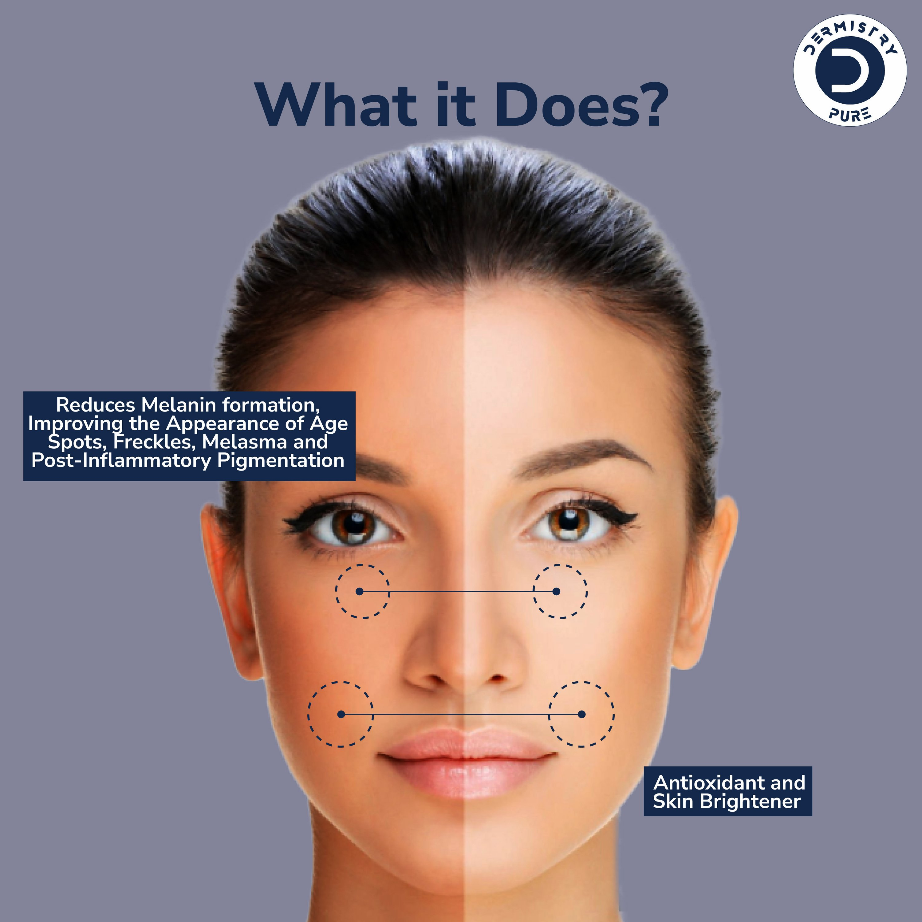 Dermistry 2% Kojic Acid 1% Alpha Arbutin Pigmentation Spots Removal Skin Brightening Face Serum