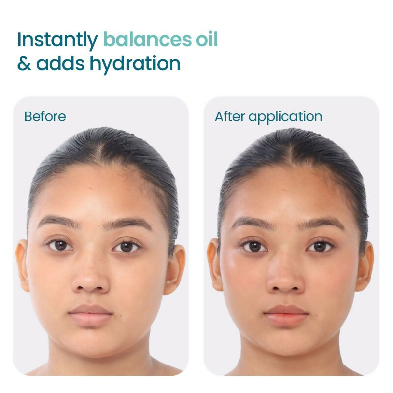 Wishcare 2:1:3 NMF Water Gel Moisturizer for Oily & Sensitive Skin, Oil-Free