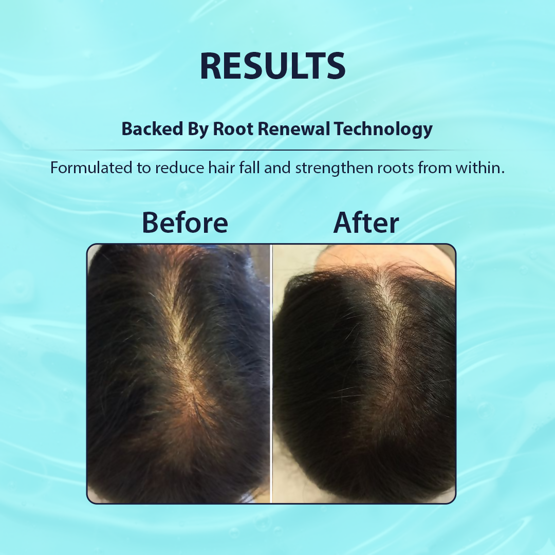 Dermistry Follicusan Hairgenyl & Caffeine Anti Hair Fall Control Serum