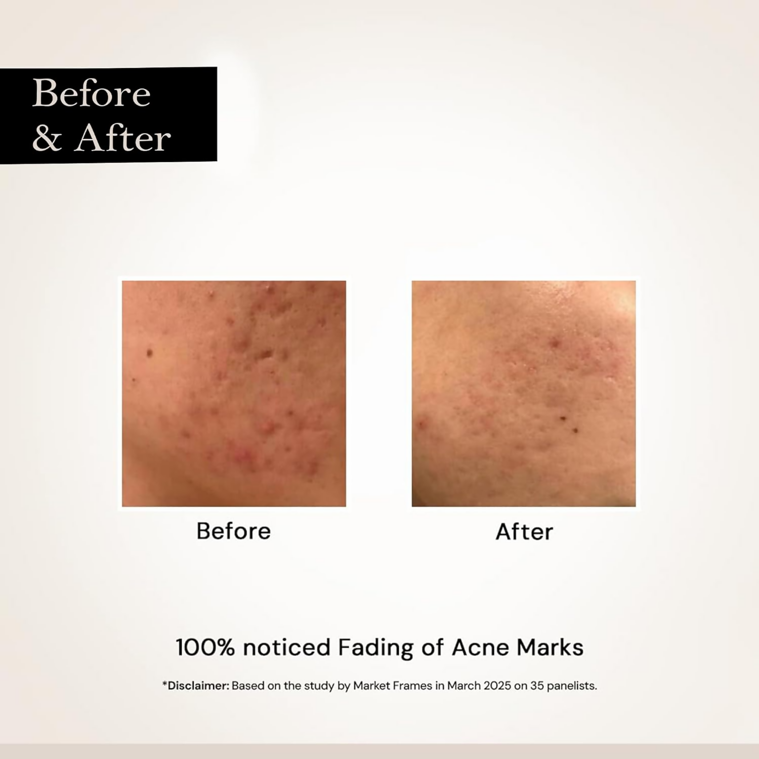 Milky Moon Face Glow Night Serum Dark Spot & Brightening Face Serum