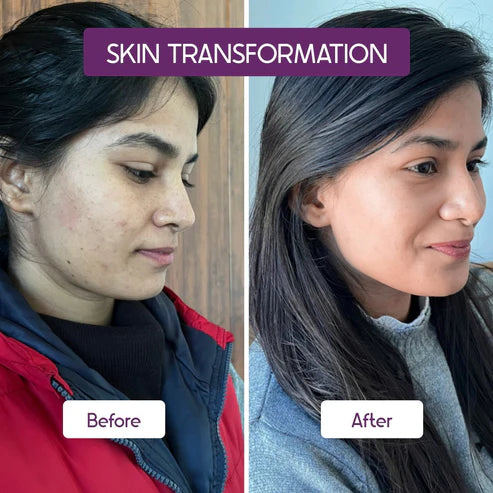 COAIQ Salicylic Acid BHA-2% Encapsulated, 30ml Regular