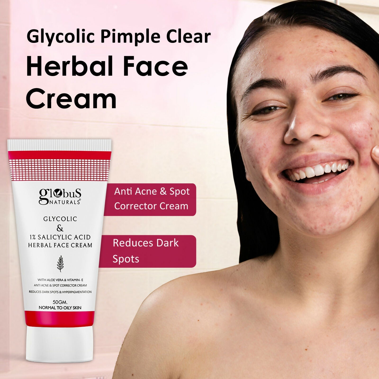 Globus Naturals Glycolic & 1% Salicylic Acid Herbal Anti Acne Face Cream