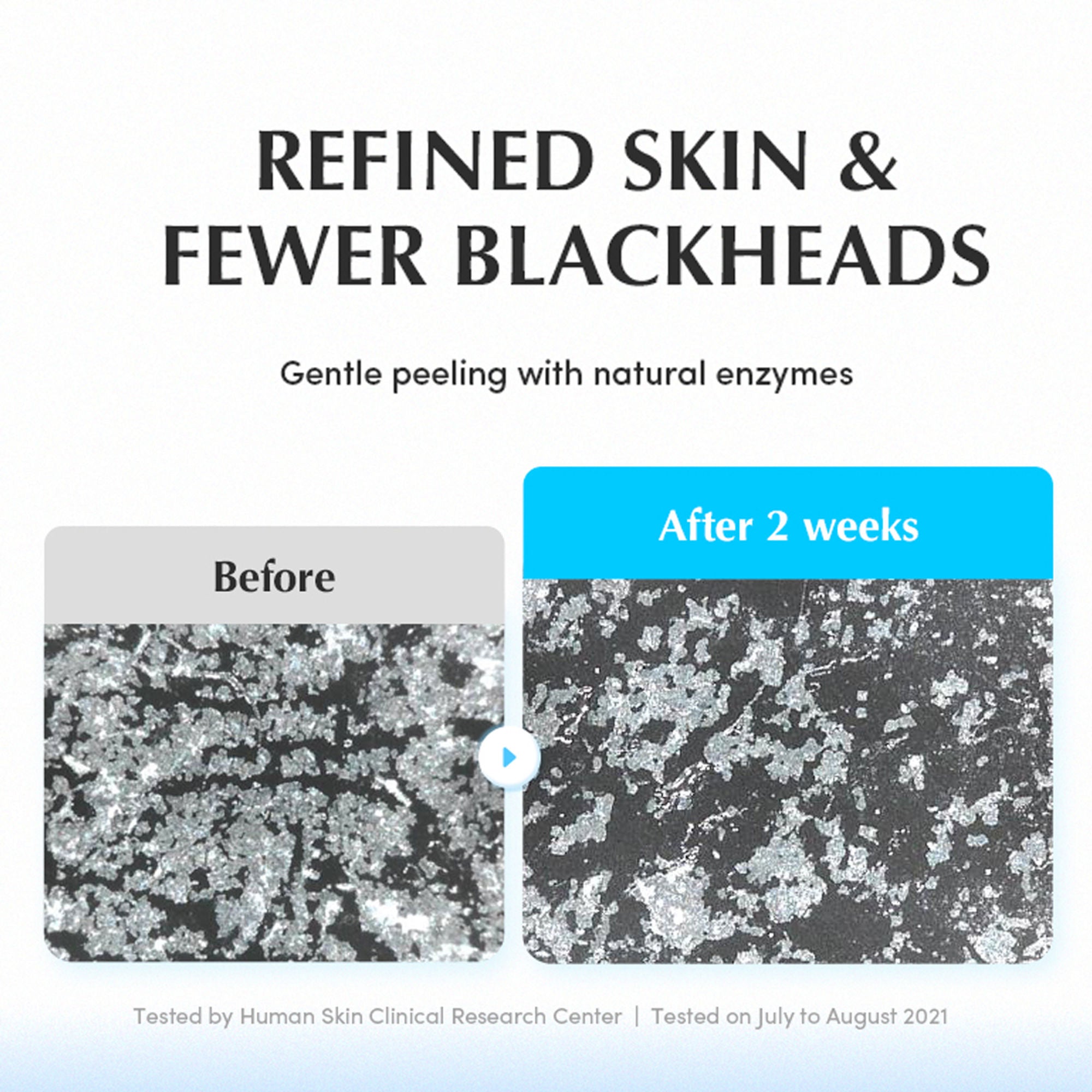 Eqqualberry Swimming Pool Toner 5 Berry Complex & Hyaluronic Acid,Pore Refining & Gentle Exfoliation