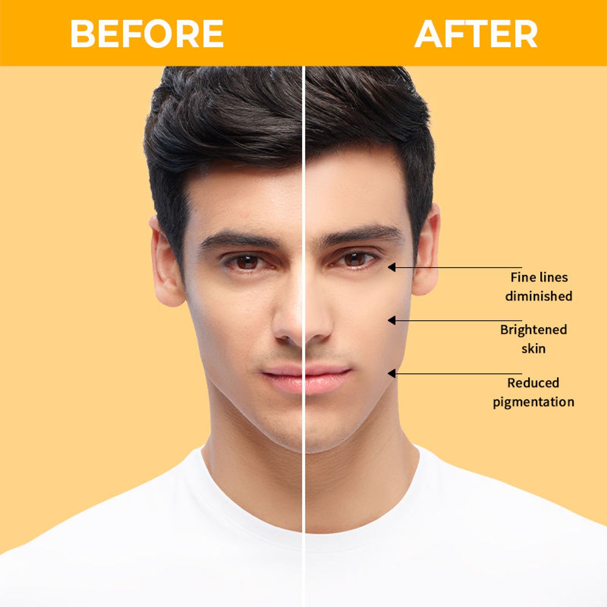 Nykaa SkinRX 20% Vitamin C + 1% Hyaluronic Acid Serum for Bright, Radiant and Hydrated Skin