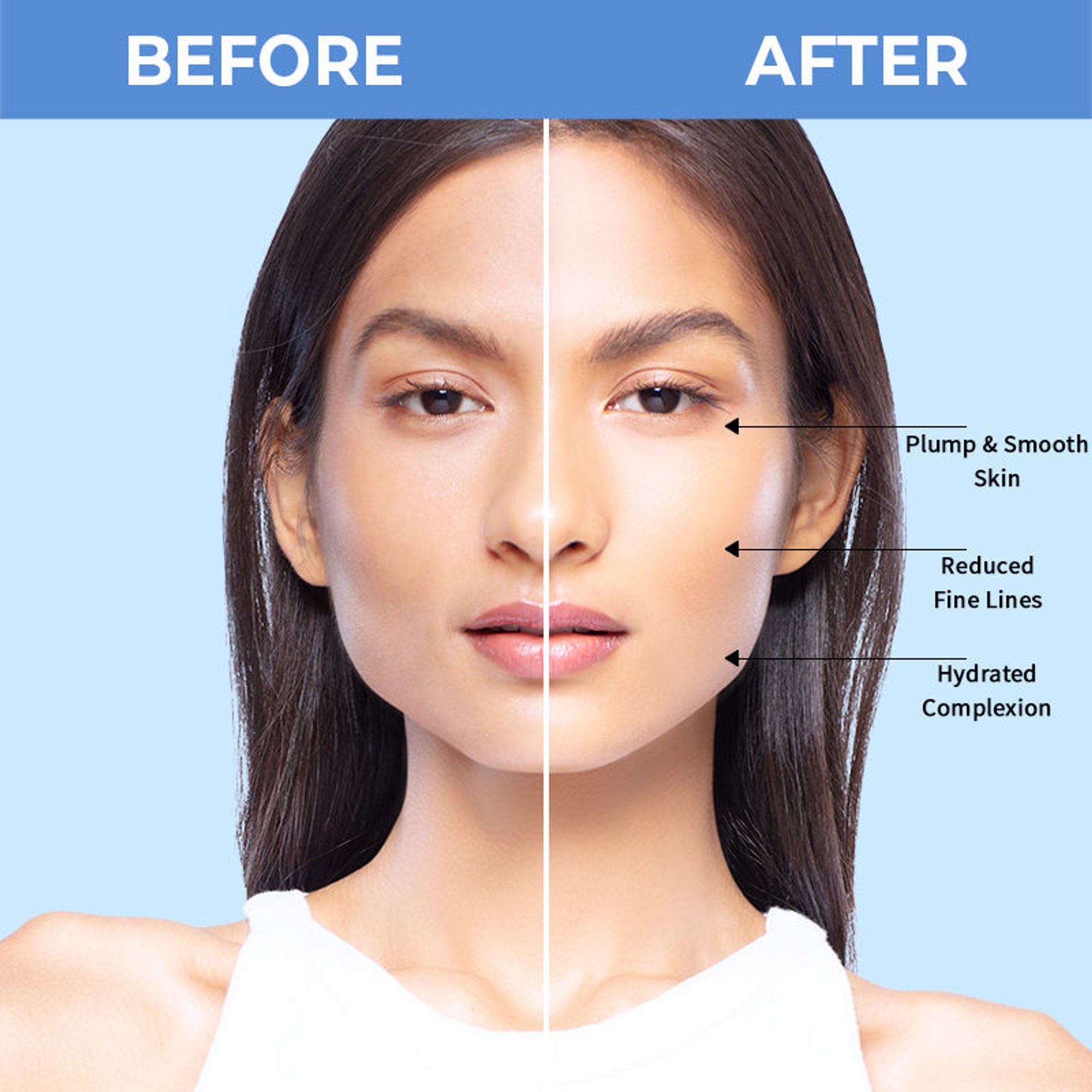 Nykaa SkinRX Hydra X with 2% Hyaluronic Acid + 1% Vitamin B5 Serum for Deep Hydration & Soft Skin