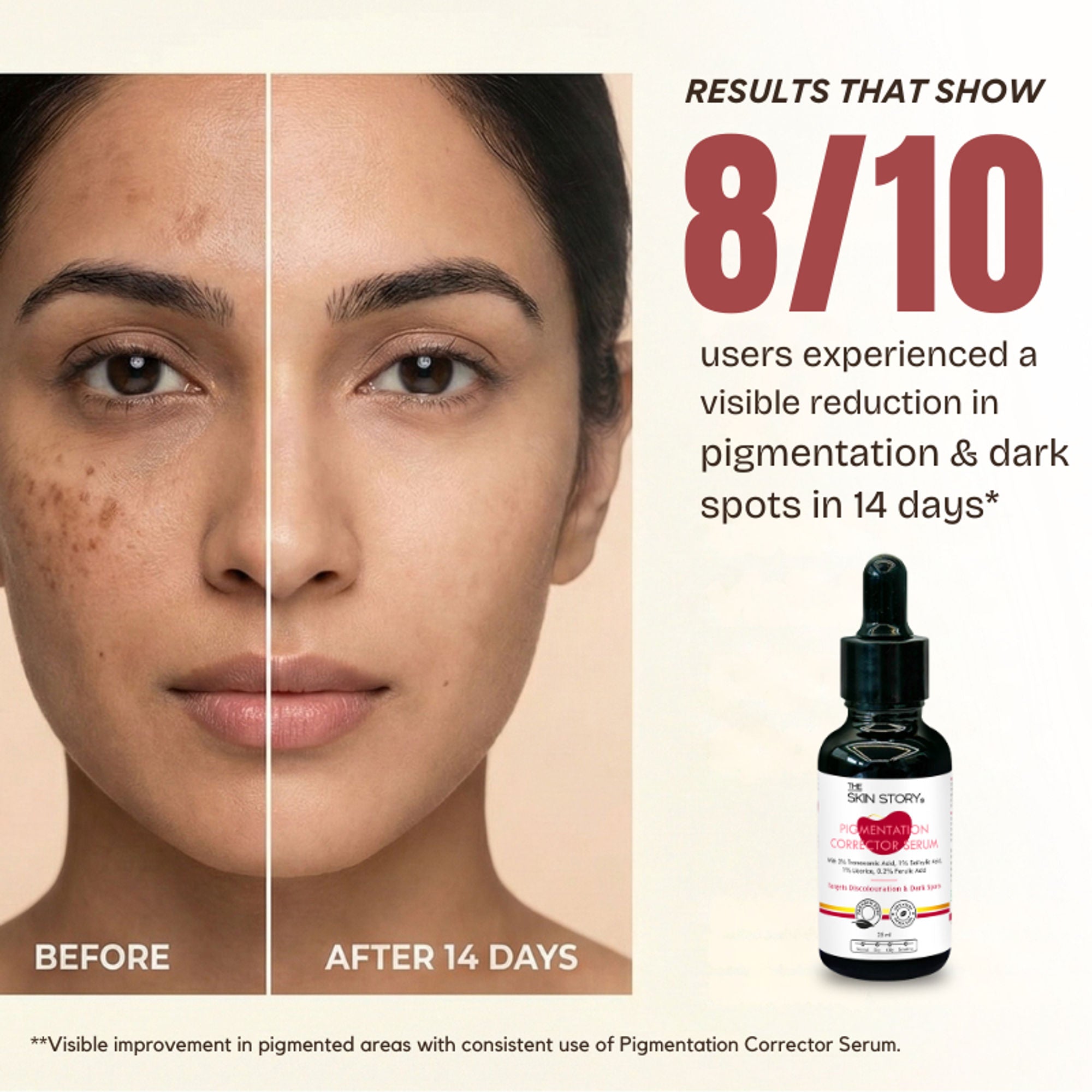 The Skin Story Anti Pigmentation Face Serum For Brighter Skin, Dark Spots, Niacinamide Alpha Arbutin