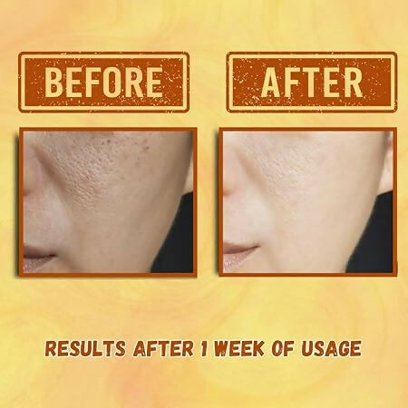 Our Cares Vitamin C Face Cream for Glowing & Clear Skin