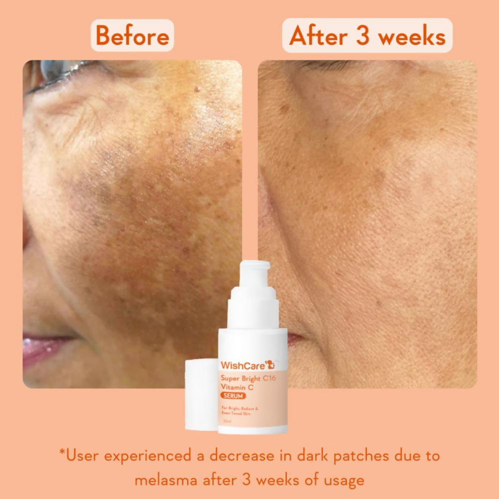 Wishcare Super Bright C16 Vitamin C Face Serum