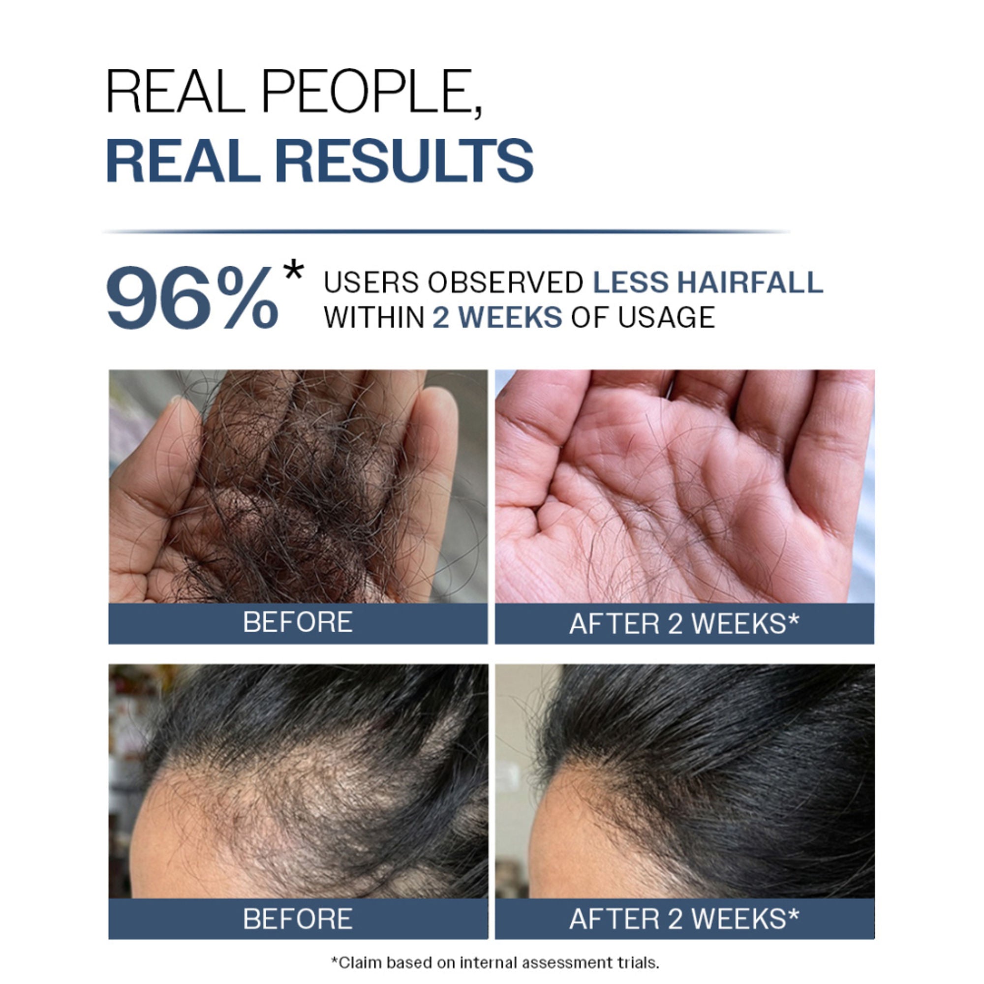 Bare Anatomy Anti-Hair Fall Shampoo 5X Hair Fall Control With Peptides