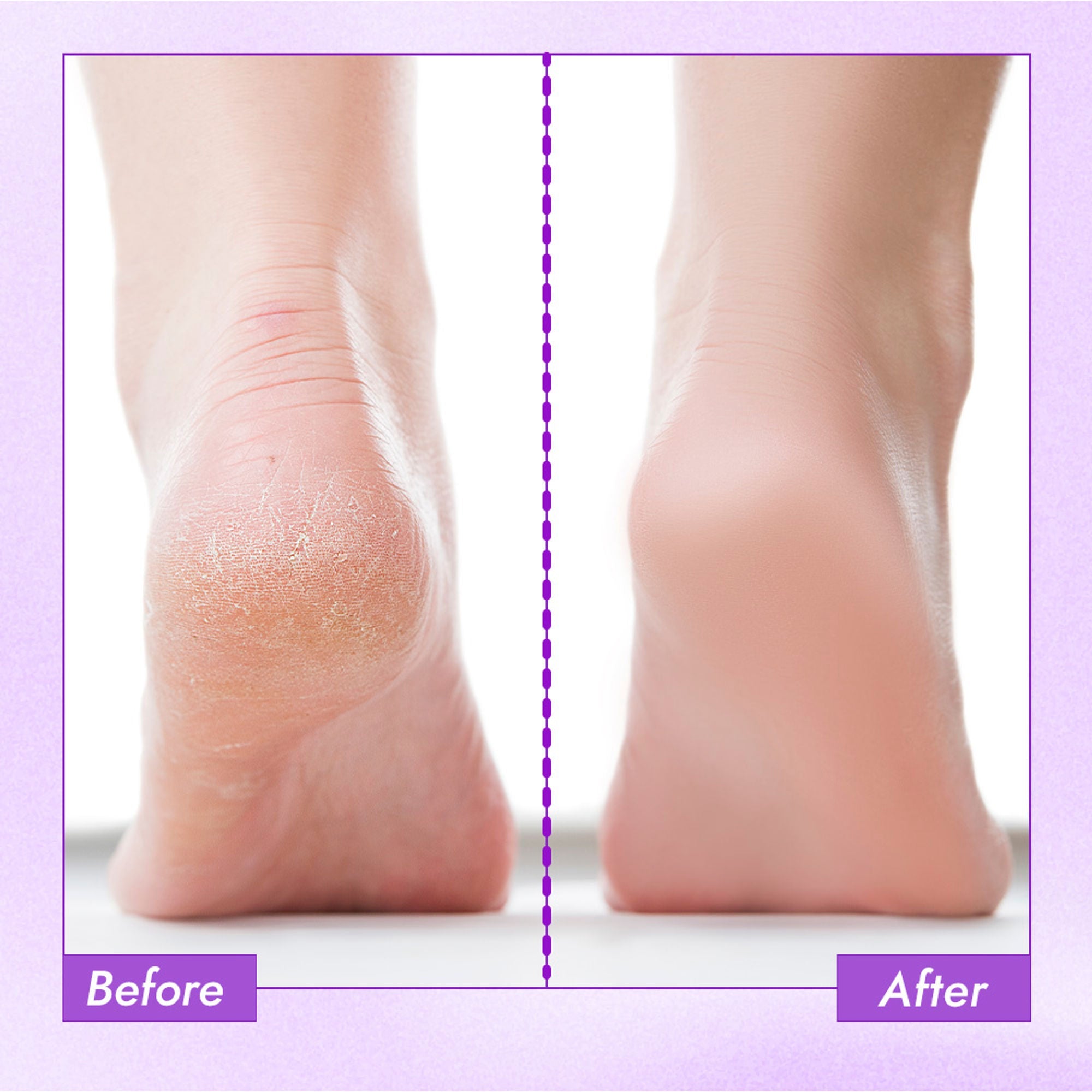 Nykaa Skin Happy Heels 20%Urea, 2%Lactic Acid Foot Cream-Dry & Cracked Feet - Lavender & Peppermint