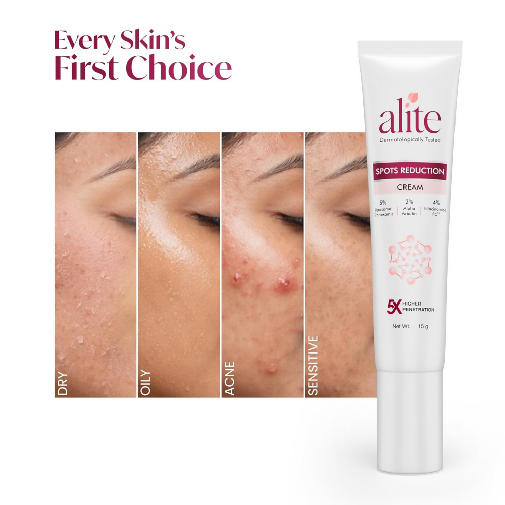 Alite Spots Reduction Cream with 5X Enhanced Absorption