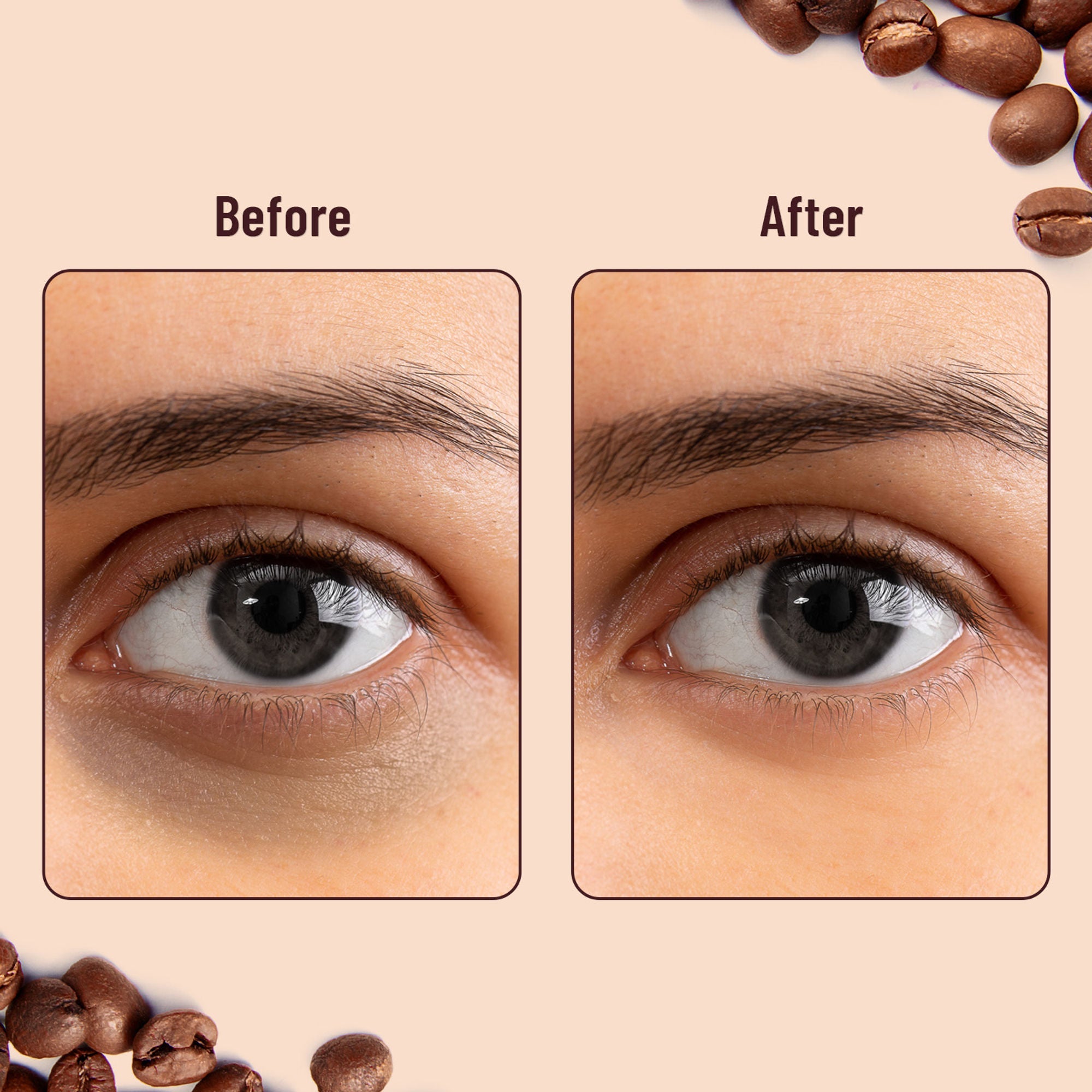 Swiss Beauty Hydra Eye Serum Patches For Dark Circles And Puffiness , Hydrate Skin - Coffee