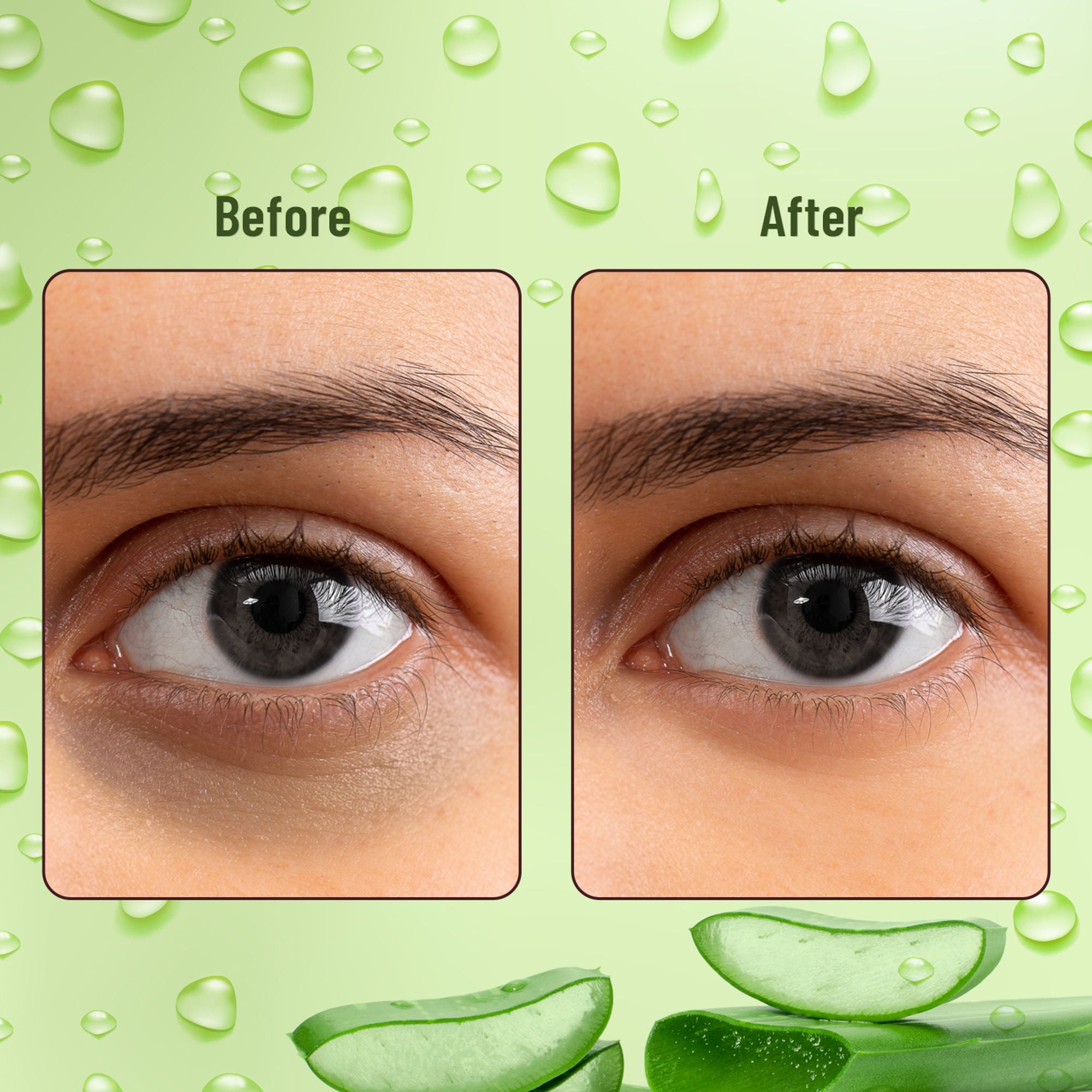 Swiss Beauty Hydra Eye Serum Patches For Dark Circles And Puffiness , Hydrate Skin - Alove Vera