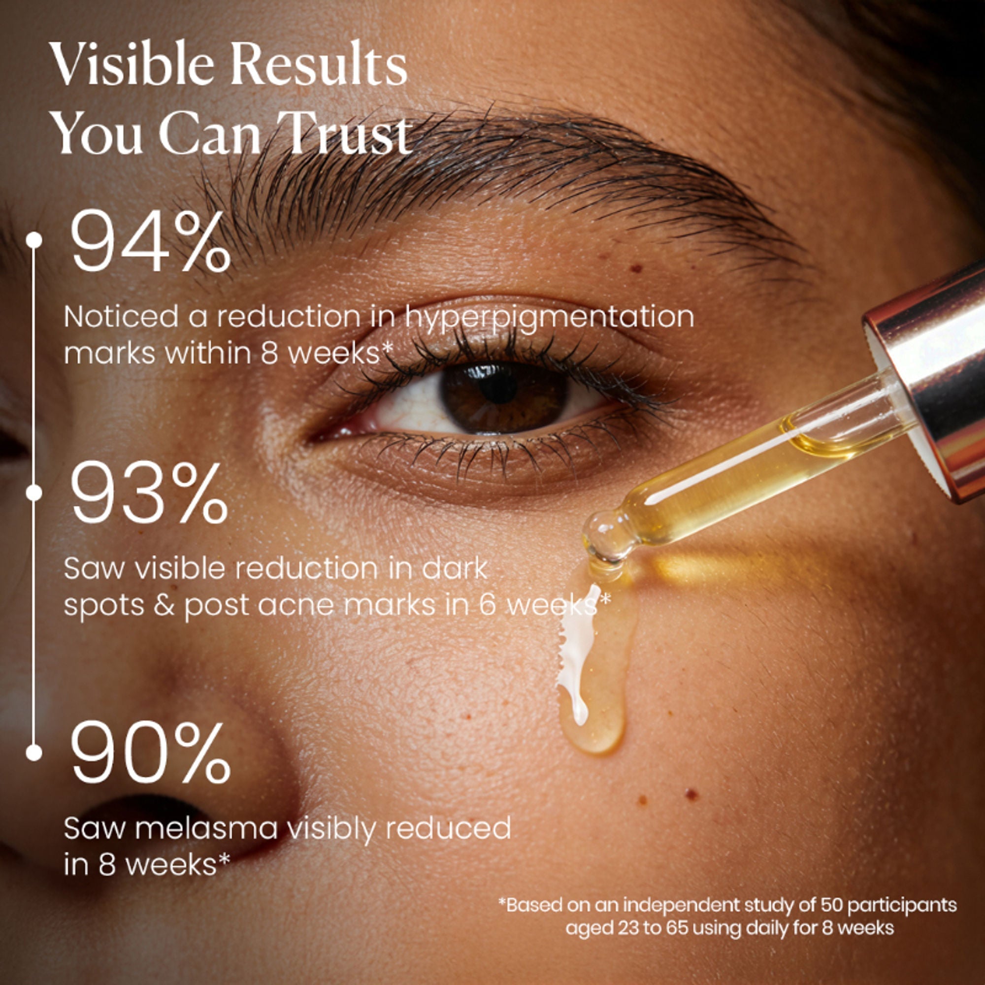 BiE - Beauty In Everything Zero Dark Spot Corrector & Anti-Pigmentation Serum
