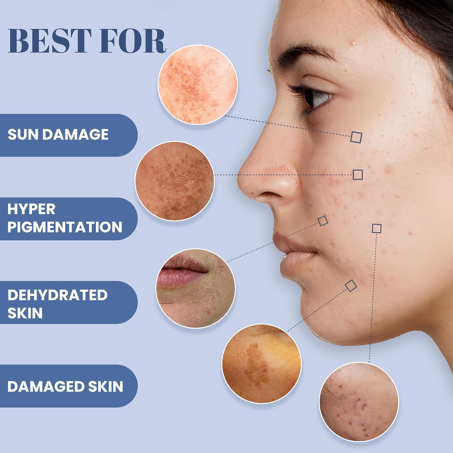 WildOak 5% Vitamin C & Niacinamide Super Brightening Face Moisturizer | 100ml Bottle | Ashwagandha | Acne Scars & Hyperpigmentation | Repairs Damaged Skin | Reduces Skin Dullness | For All Skin Types